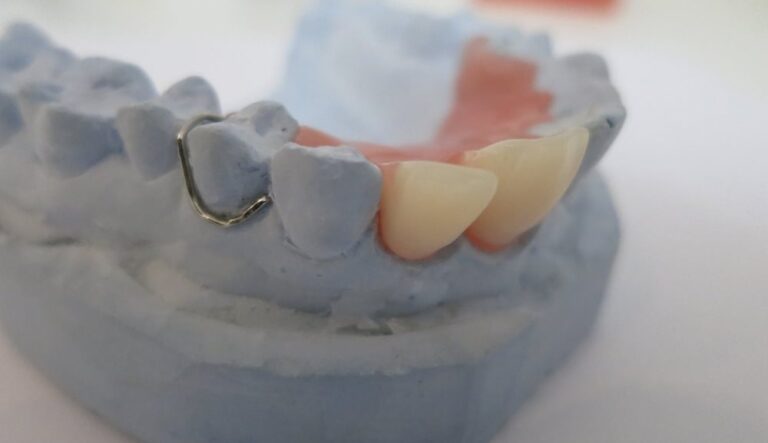 Immediate denture