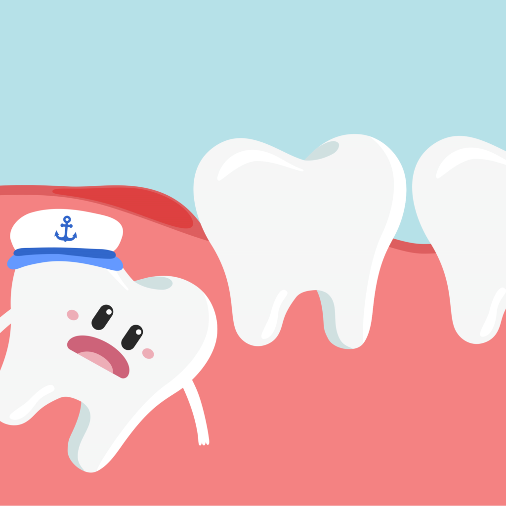 Removing Wisdom Tooth (Total Cost Breakdown)