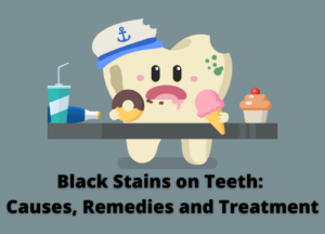 black stains on teeth