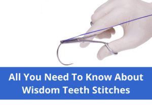 wisdom teeth stitches